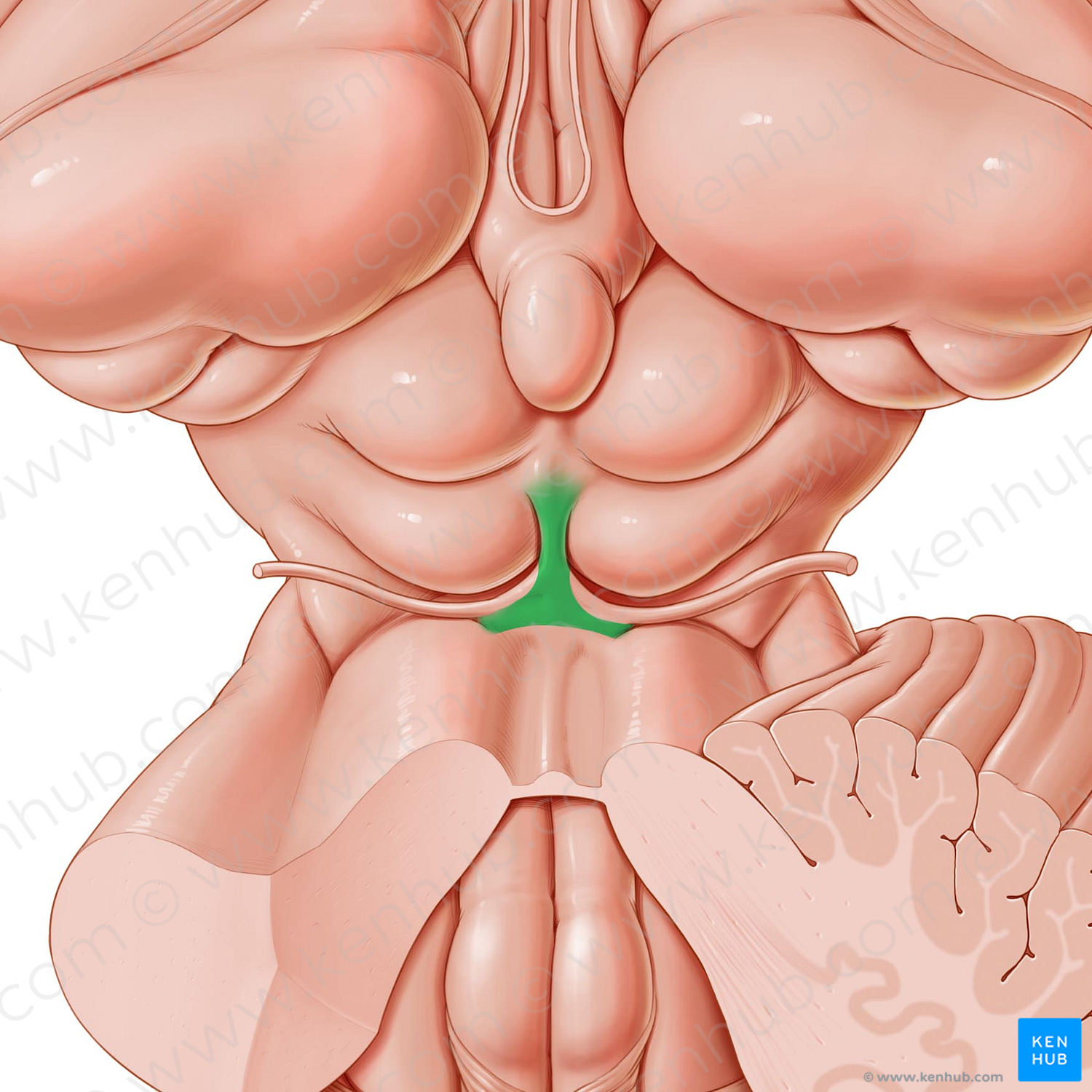 Frenulum of superior medullary velum (#3917)