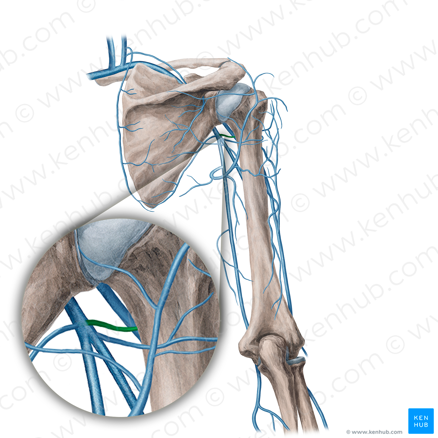 Anterior circumflex humeral vein (#21738)