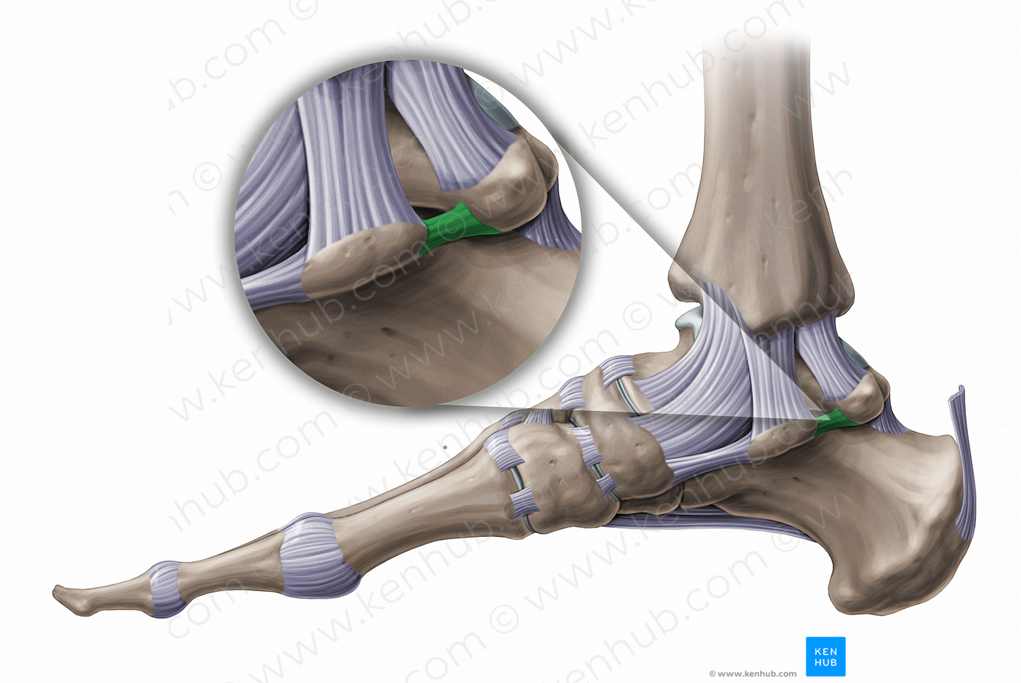 Medial talocalcaneal ligament (#11242)