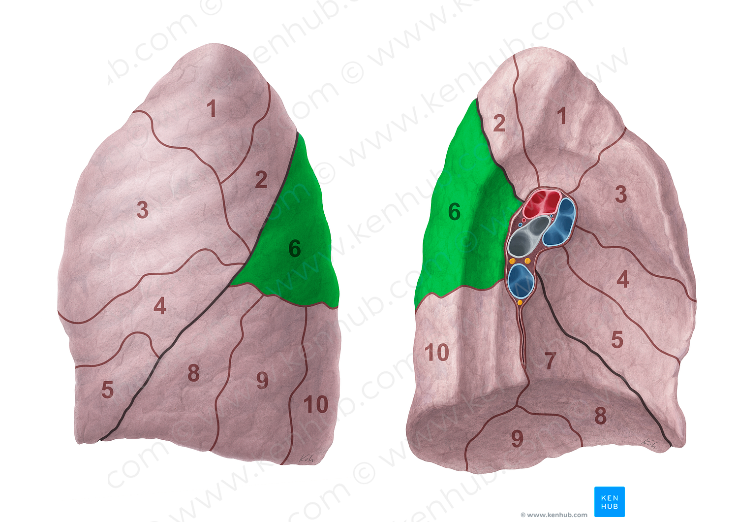 Superior segment of left lung (#20702)