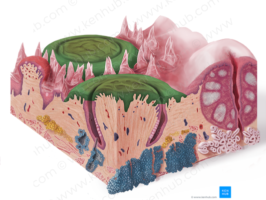 Vallate papillae (#7636)