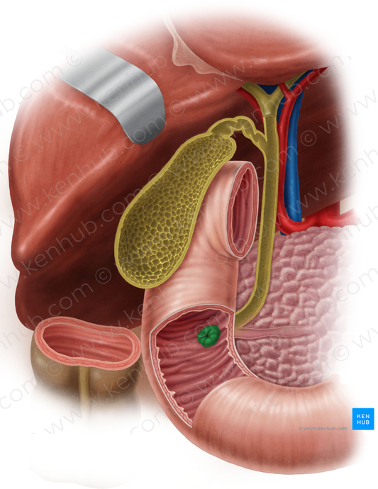 Major duodenal papilla (#7621)