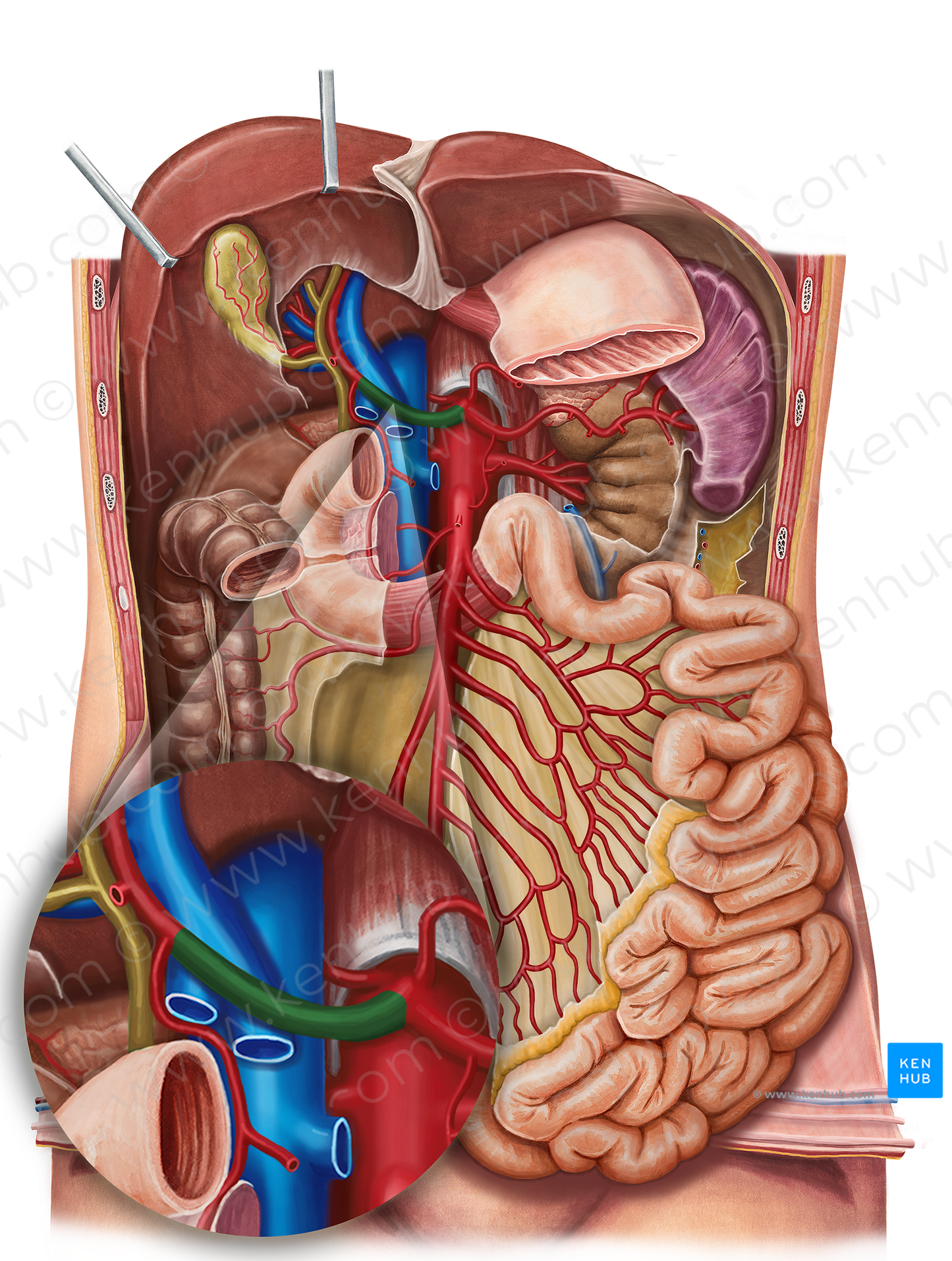 Common hepatic artery (#1335)