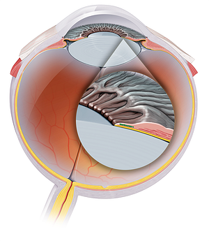 Sphincter pupillae muscle of iris (#19139)