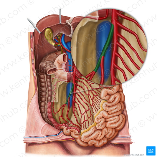 Ileocolic artery (#1360)