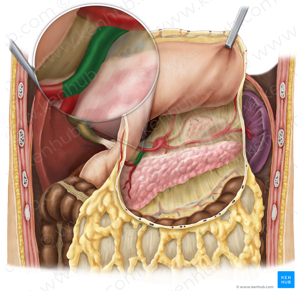 Gastroduodenal artery (#1291)
