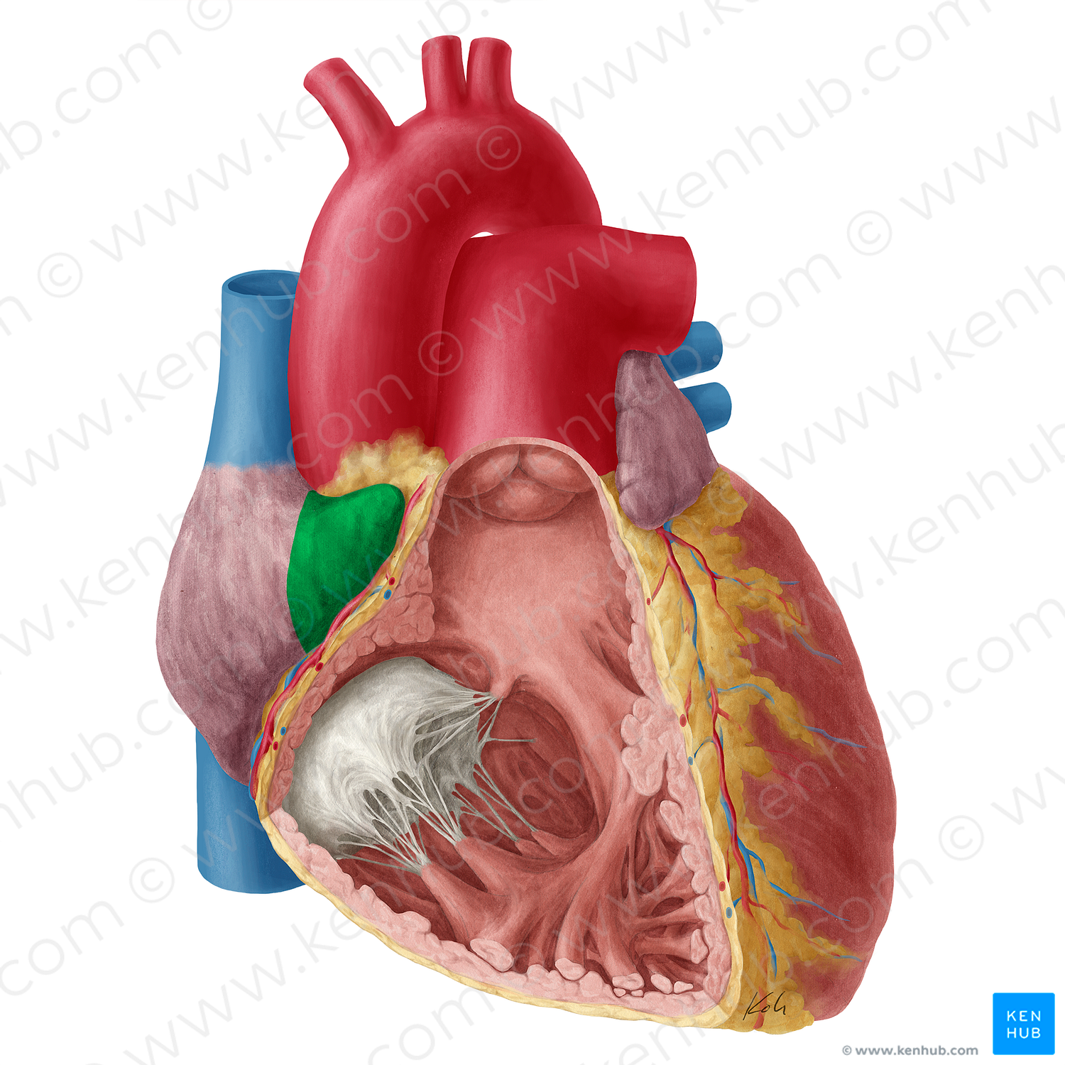 Right auricle of heart (#2126)