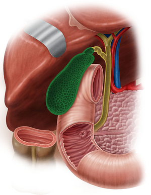 Gallbladder (#10802)