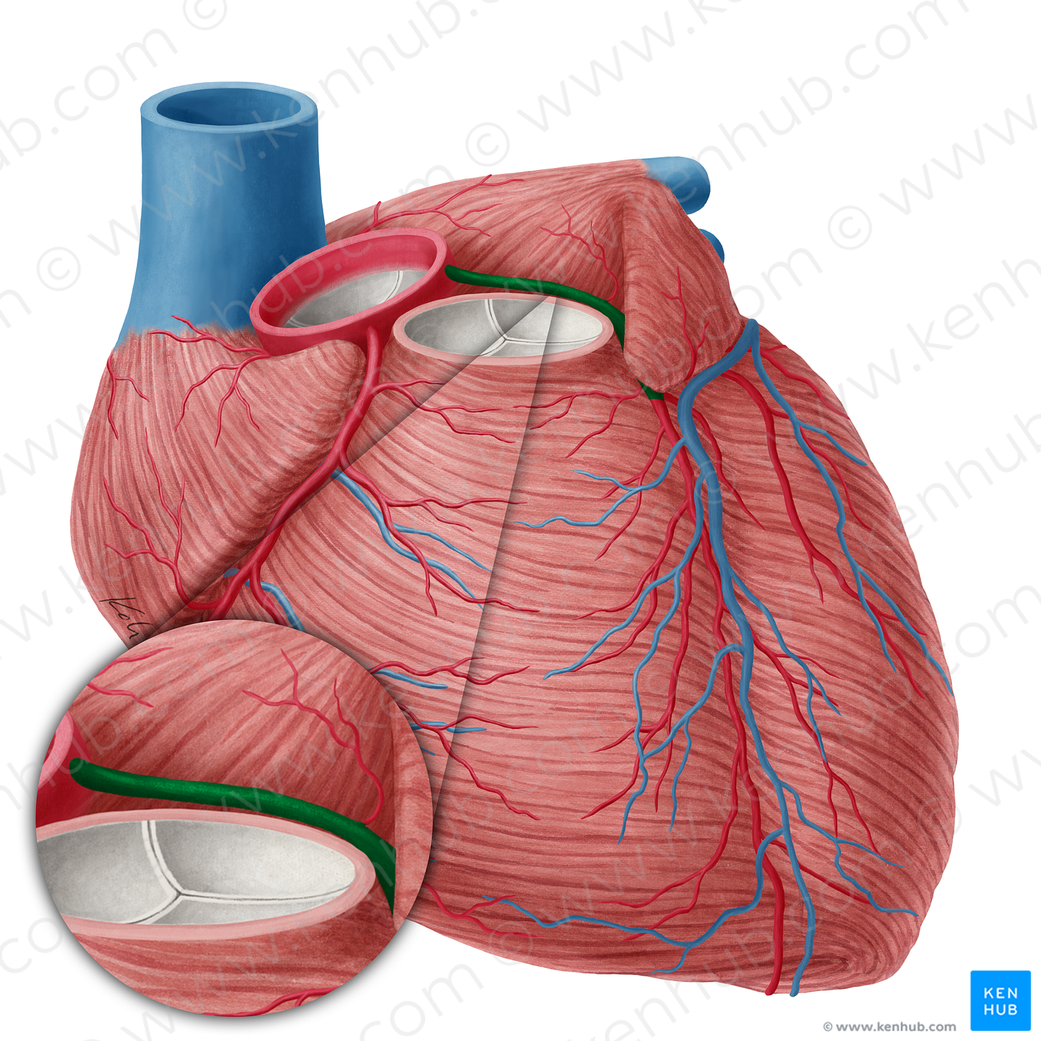 Left coronary artery (#19738)