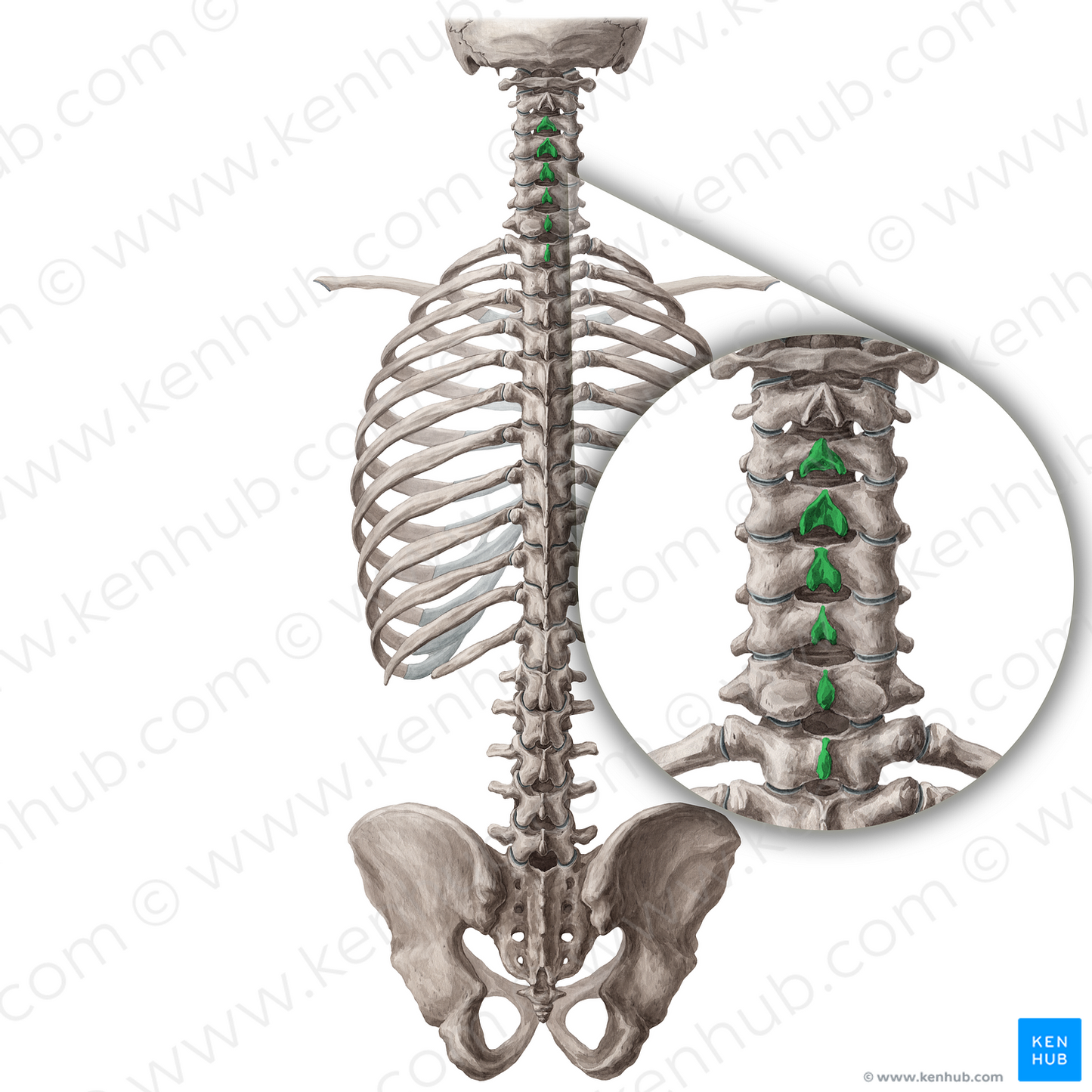 Spinous processes of vertebrae C3-T1 (#19754)