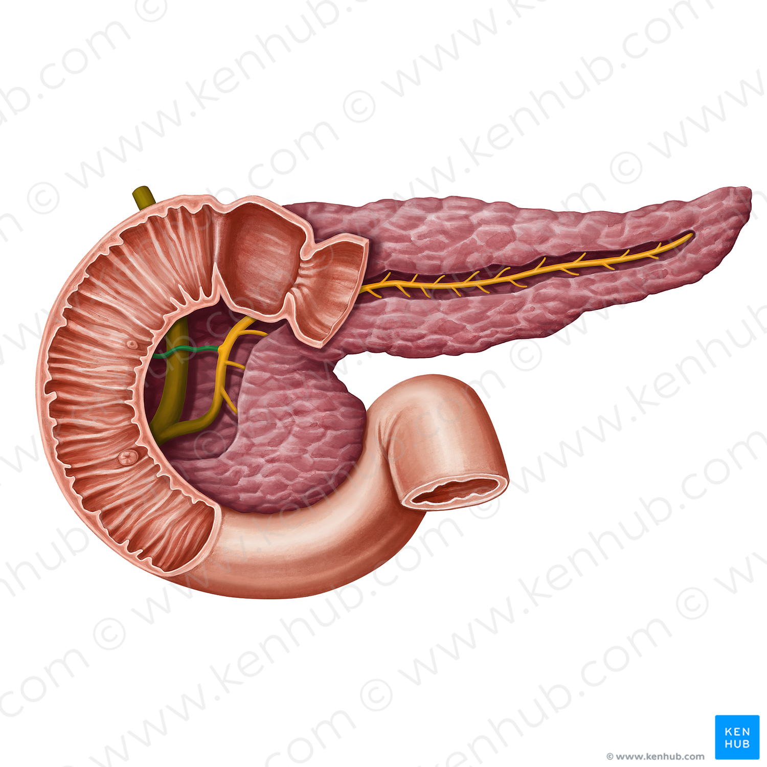 Accessory pancreatic duct (#13936)