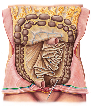 Inferior epigastric artery (#1186)