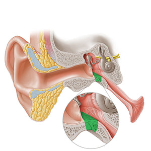 Jugular wall of tympanic cavity (#20265)