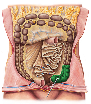 Sigmoid colon (#2742)