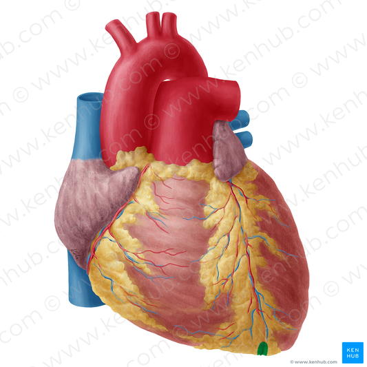 Notch of cardiac apex (#20251)