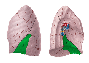 Anteromedial basal segment of left lung (#20705)