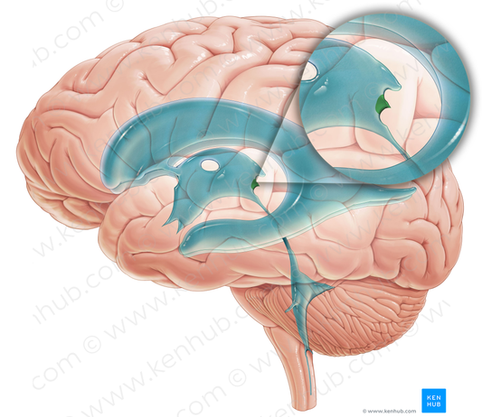 Pineal recess of third ventricle (#8853)