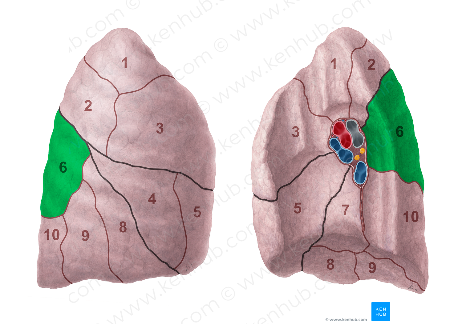 Superior segment of right lung (#20693)
