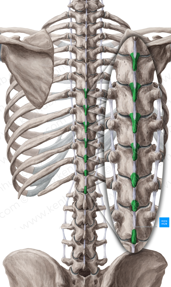 Spinous processes of vertebrae T6-T12 (#8281)