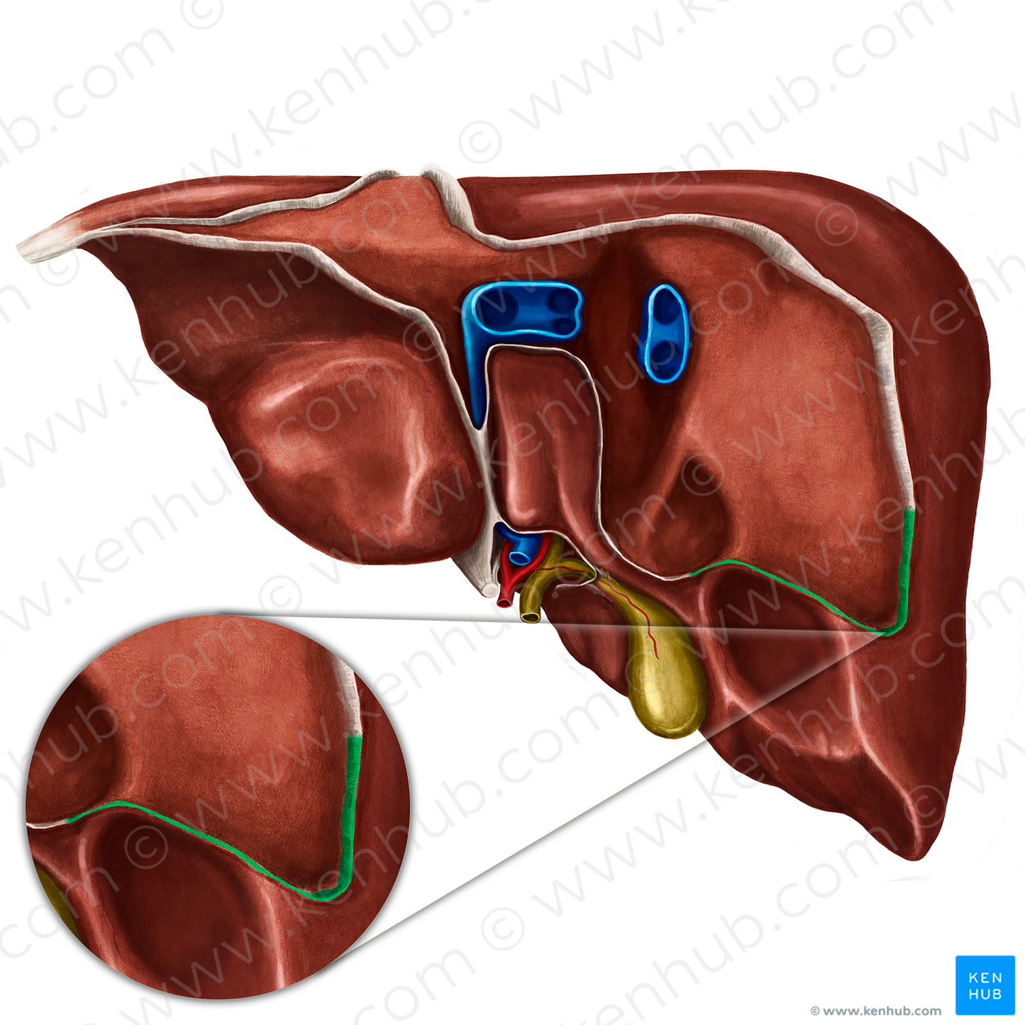 Right triangular ligament of liver (#4665)