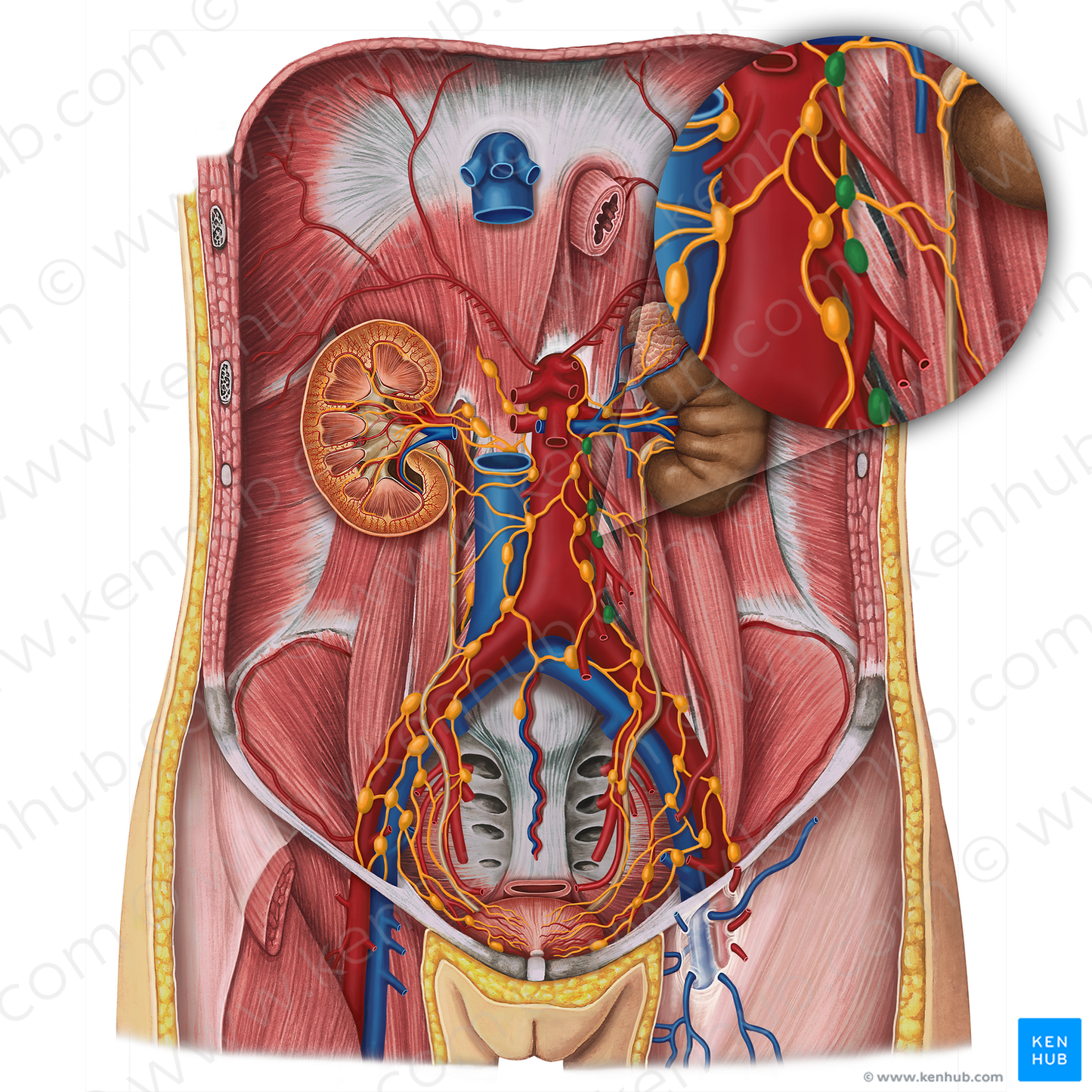 Lateral aortic lymph nodes (#6953)