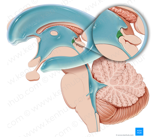 Pineal recess of third ventricle (#8852)