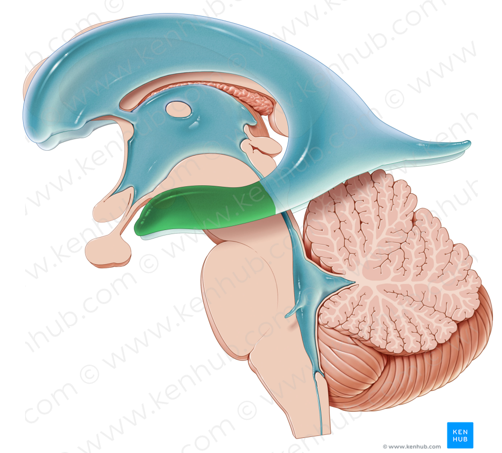 Temporal horn of lateral ventricle (#2860)