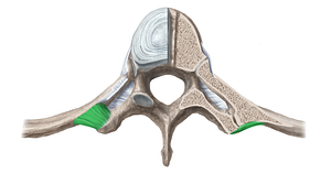 Lateral costotransverse ligament (#11382)