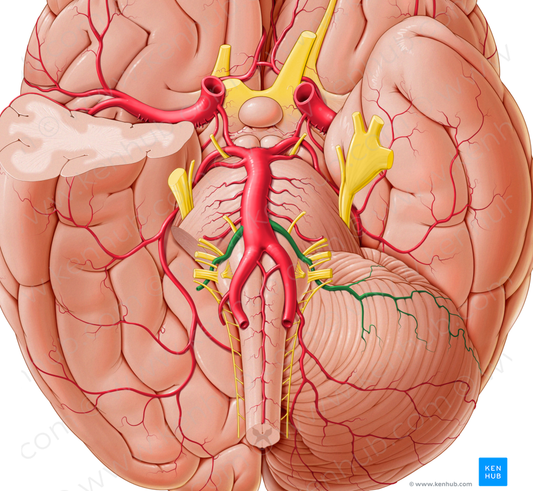 Anterior inferior cerebellar artery (#1000)