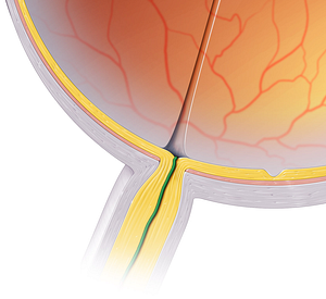 Central retinal artery (#999)