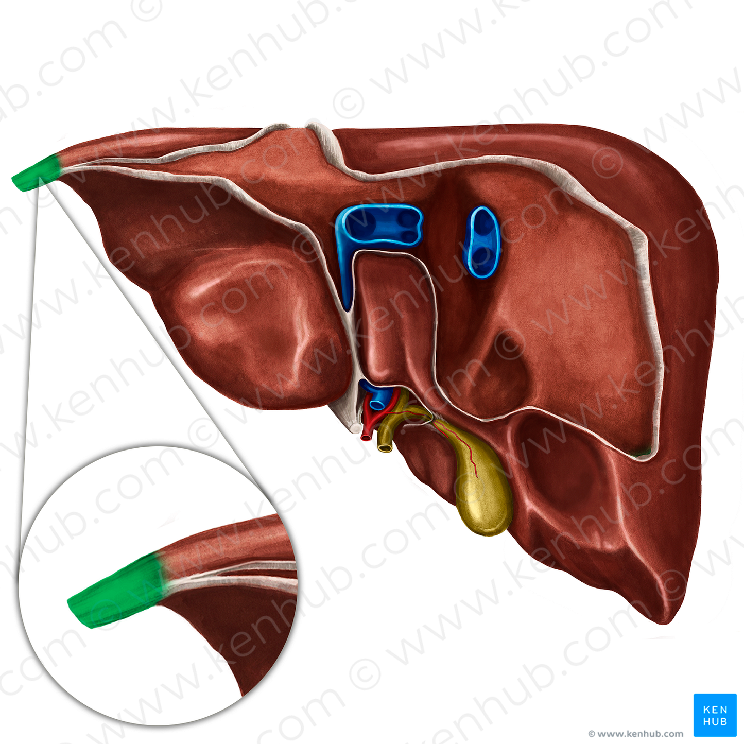 Fibrous appendix of liver (#790)