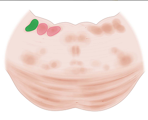 Superior vestibular nucleus (#7277)