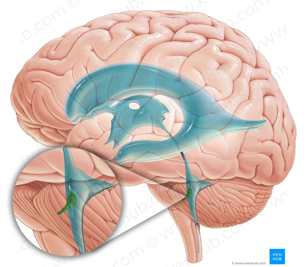 Lateral recess of fourth ventricle (#8847)