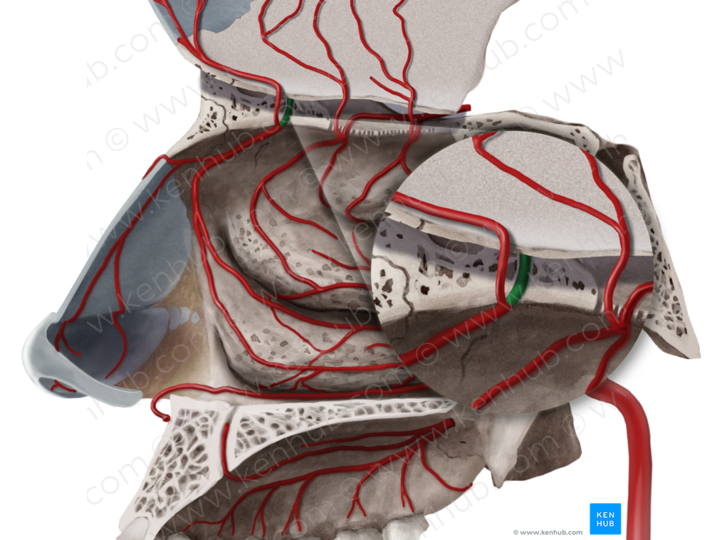 Anterior ethmoidal artery (#1227)