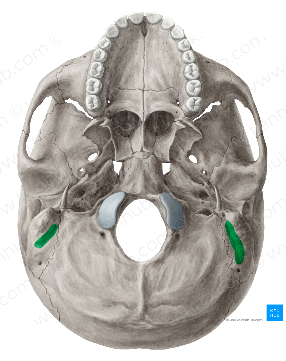 Mastoid notch of temporal bone (#4301)