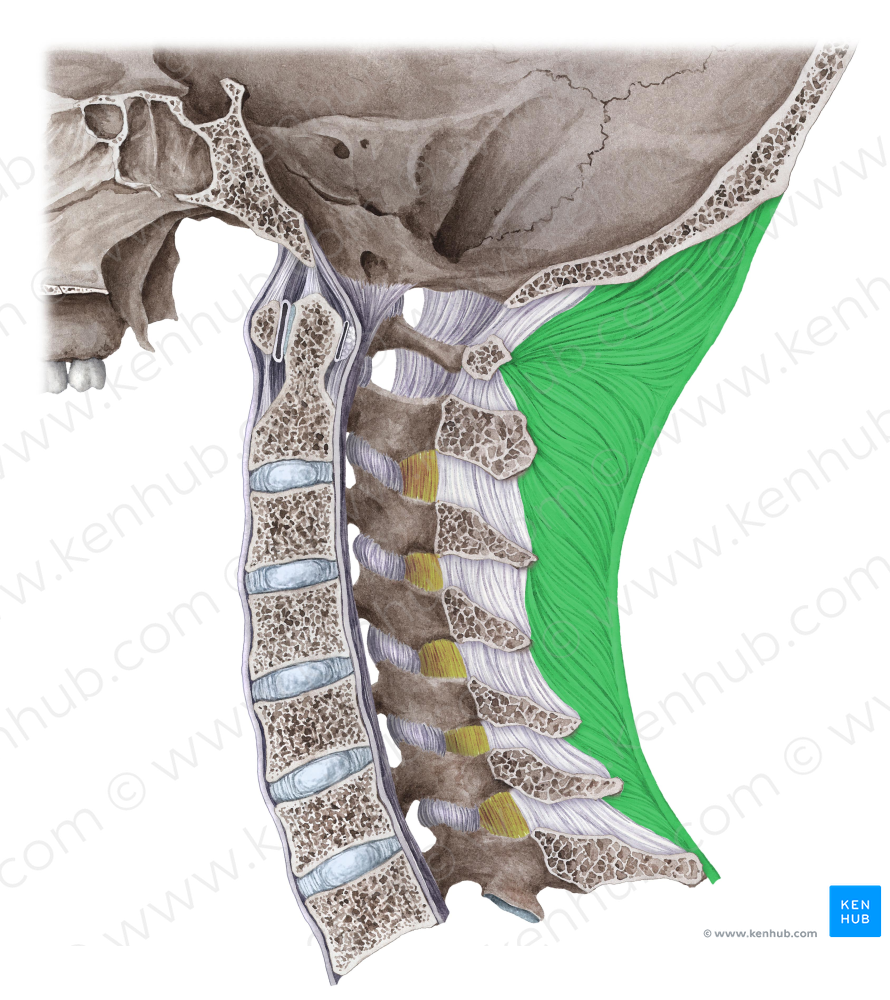 Nuchal ligament (#4582)