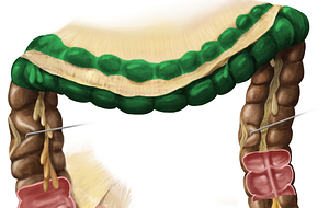 Transverse colon (#2767)