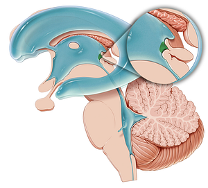 Pineal recess of third ventricle (#8852)