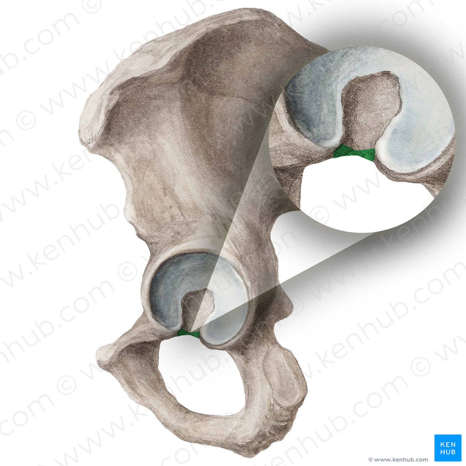 Acetabular notch of hip bone (#20309)