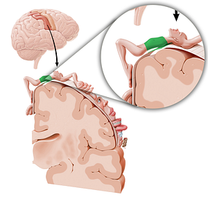 Sensory cortex of trunk (#11065)