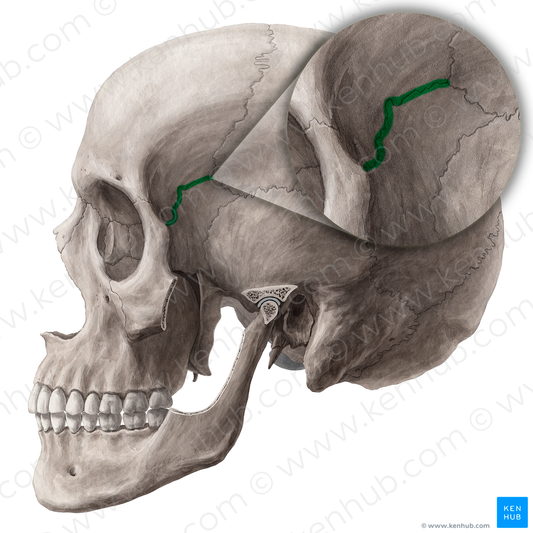 Sphenofrontal suture (#21448)