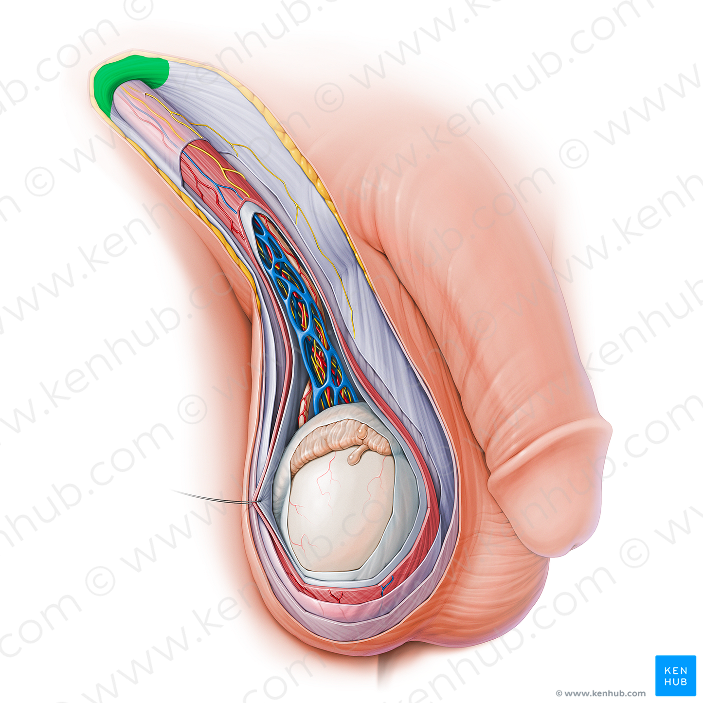 Superficial inguinal ring (#15127)