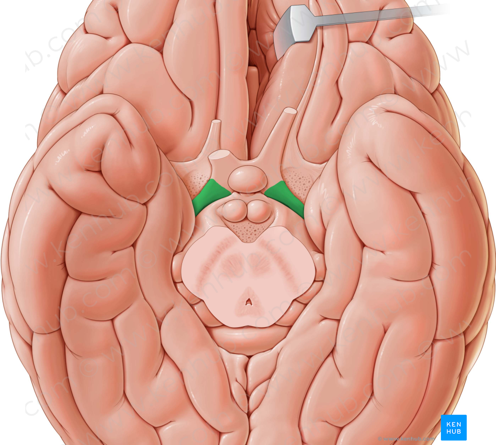 Optic tract (#9528)