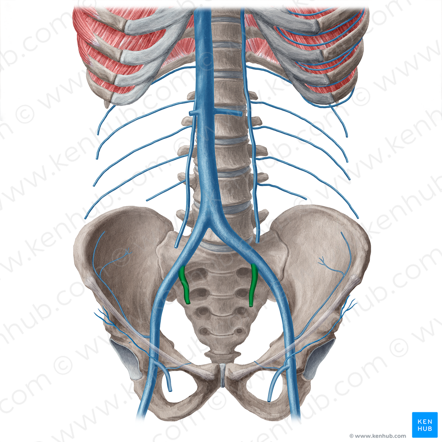 Internal iliac vein (#21553)