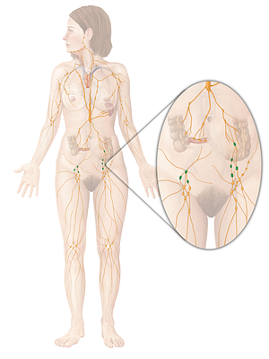 Iliac lymph nodes (#7010)