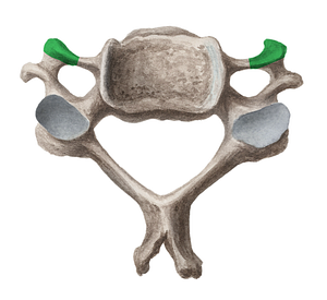 Anterior tubercle of cervical vertebra (#9707)
