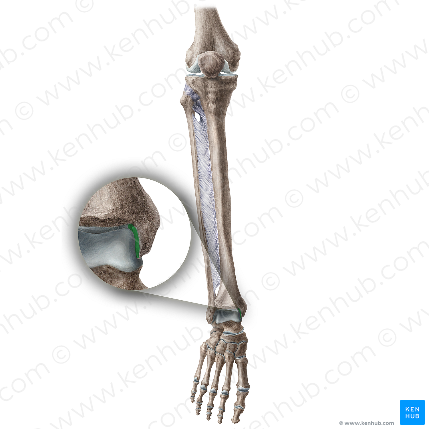 Articular facet of medial malleolus of tibia (#20606)