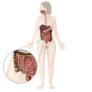 Vermiform appendix (#797)