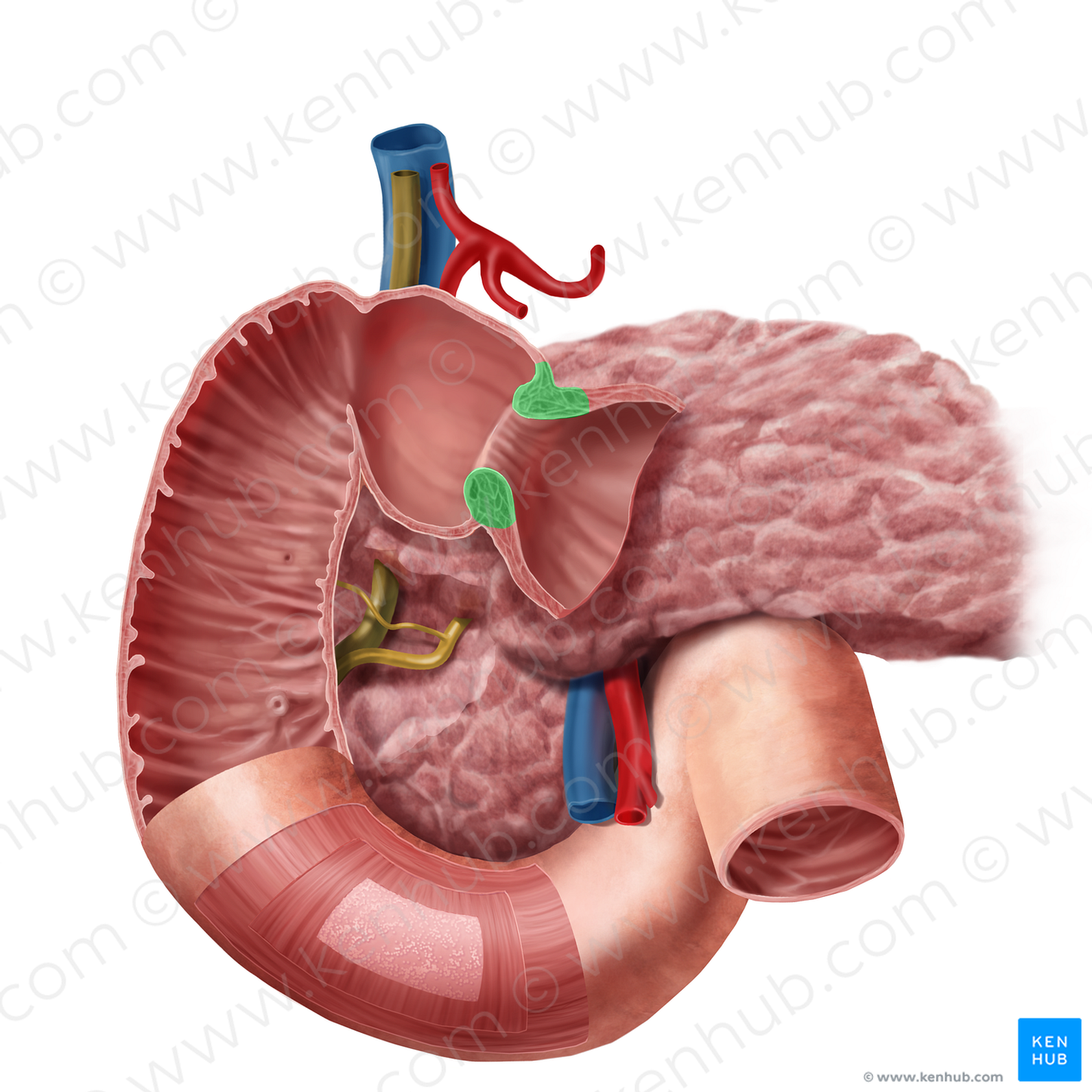 Pyloric sphincter (#11796)