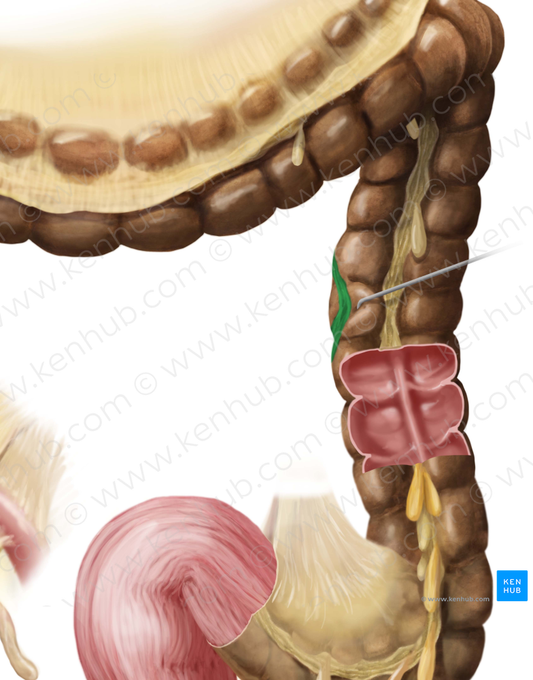 Mesocolic tenia (#9407)